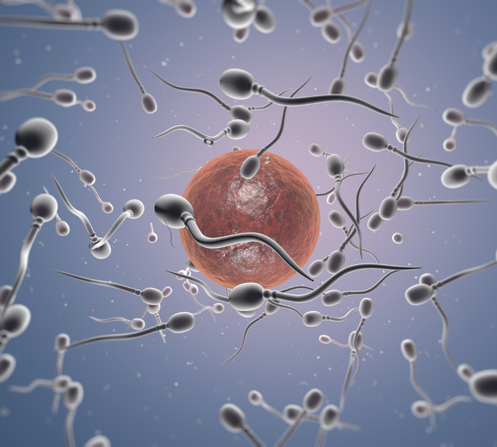 IUI (Intrauterine Insemination) – Dr. Divya Venugopalan, Bengaluru