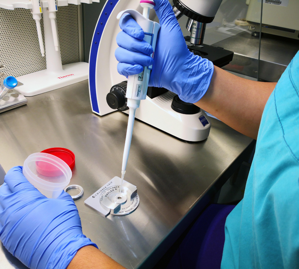 ICSI (Intracytoplasmic Sperm Injection) – Dr. Divya Venugopalan, Bengaluru