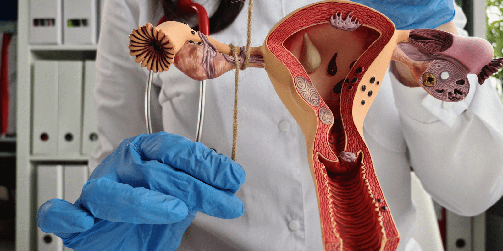 Tubal Ligation – Dr. Divya Venugopalan, Bengaluru