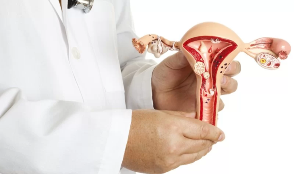 Adenomyosis