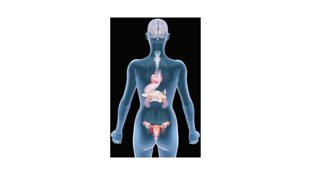 pcos causes